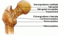 /album/fotogaleria/cadera-3-gif/